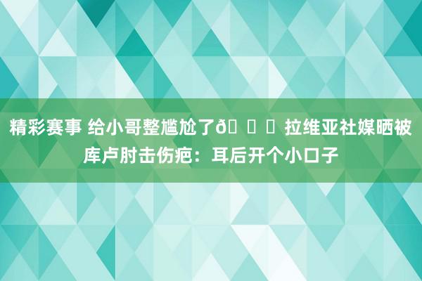 精彩赛事 给小哥整尴尬了😅拉维亚社媒晒被库卢肘击伤疤：耳后开个小口子